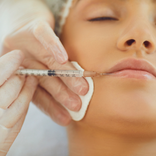 lipfiller behandeling